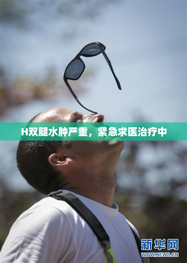 H双腿水肿严重，紧急求医治疗中