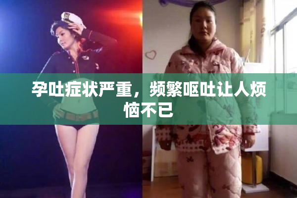 孕吐症状严重，频繁呕吐让人烦恼不已