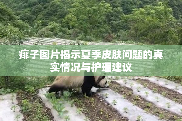 痱子图片揭示夏季皮肤问题的真实情况与护理建议
