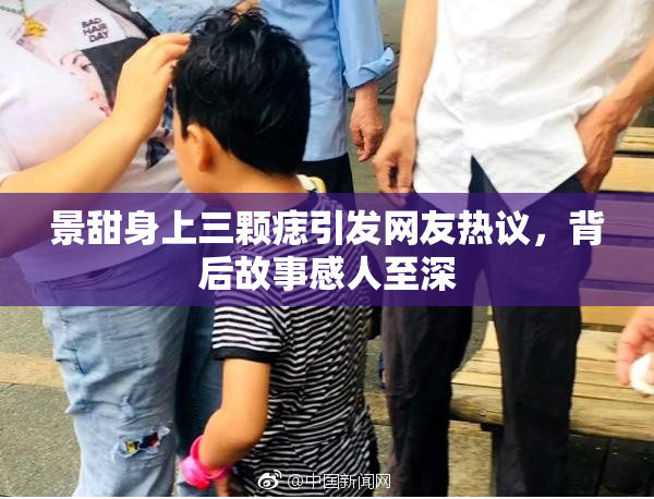 景甜身上三颗痣引发网友热议，背后故事感人至深