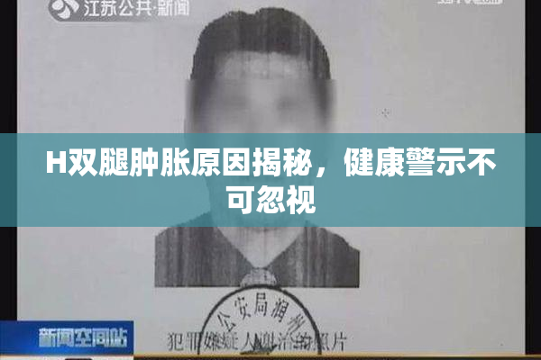 H双腿肿胀原因揭秘，健康警示不可忽视