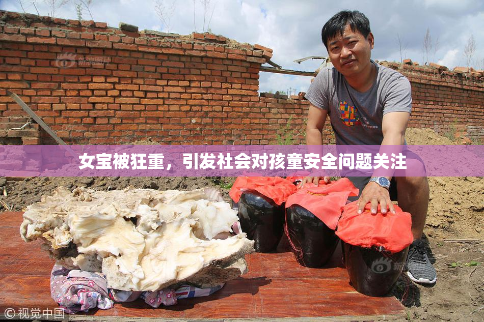 女宝被狂重，引发社会对孩童安全问题关注