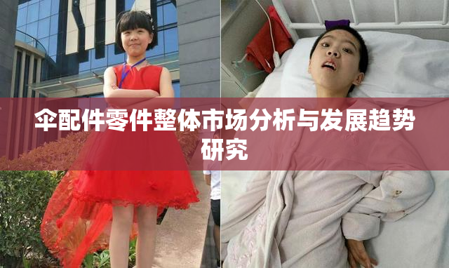 伞配件零件整体市场分析与发展趋势研究