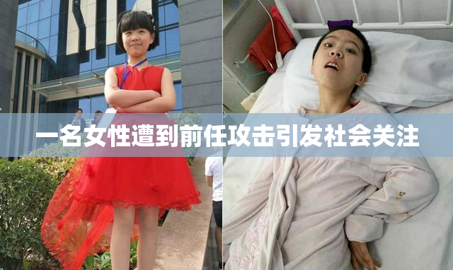 一名女性遭到前任攻击引发社会关注