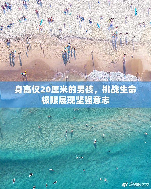身高仅20厘米的男孩，挑战生命极限展现坚强意志