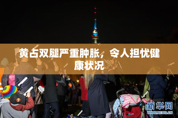 黄占双腿严重肿胀，令人担忧健康状况